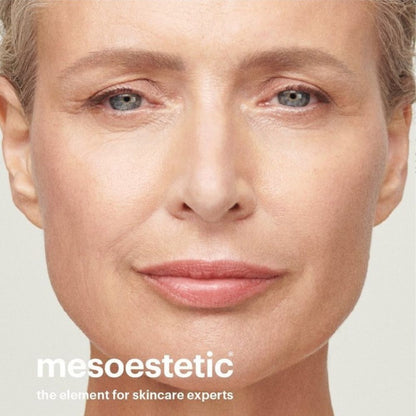 Mesoestetic Post-Procedure Fast Skin Repair (Regenerating Cream for sensitive skin) 50Ml